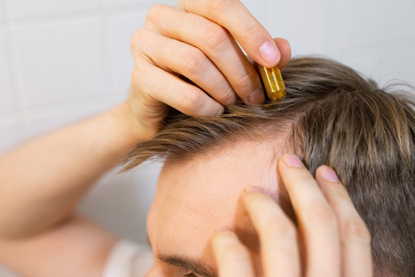 Non Surgical Hair Restoration: A Modern Solution For Thinning Hair